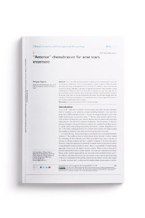 Anterior-chemabrasion-for-acne-scars